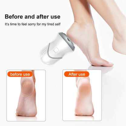 Electric Vacuum Design Foot Grinder Household Multifunctional Pedicure Calluses Foot Care, Specification:Silver Foot Grinder - Grinding Tools & Accessories by PMC Jewellery | Online Shopping South Africa | PMC Jewellery | Buy Now Pay Later Mobicred