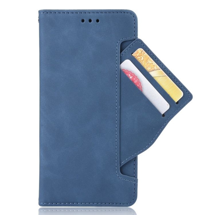 For Blackview A55 Skin Feel Calf Pattern Leather Phone Case(Blue) - More Brand by PMC Jewellery | Online Shopping South Africa | PMC Jewellery | Buy Now Pay Later Mobicred