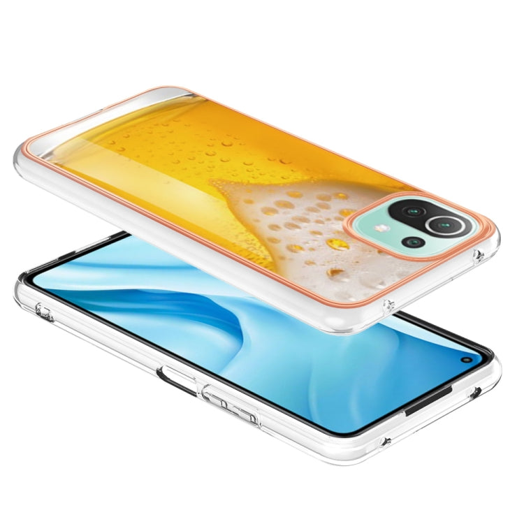 For Xiaomi 11 Lite Electroplating Marble Dual-side IMD Phone Case(Draft Beer) - Xiaomi Cases by PMC Jewellery | Online Shopping South Africa | PMC Jewellery | Buy Now Pay Later Mobicred