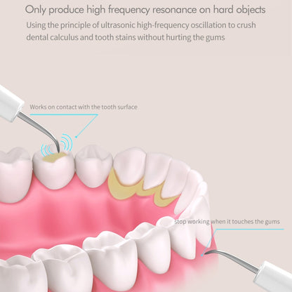 Ultrasonic Scaler Household Electric Dental Cleaner Tooth Scaling Machine(Standard Version) - Oral Irrigators by PMC Jewellery | Online Shopping South Africa | PMC Jewellery | Buy Now Pay Later Mobicred