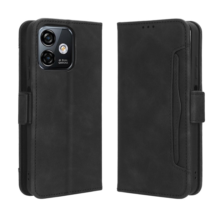 For Ulefone Note 16 Pro Skin Feel Calf Texture Card Slots Leather Phone Case(Black) - Ulefone Cases by PMC Jewellery | Online Shopping South Africa | PMC Jewellery