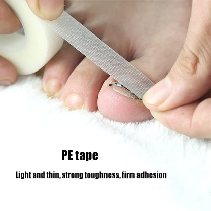 Orthopedic Buckle Toe Nail Groove Ingrown Nail Corrector, Style:No. 42, Specifications:Set - Corrector by PMC Jewellery | Online Shopping South Africa | PMC Jewellery